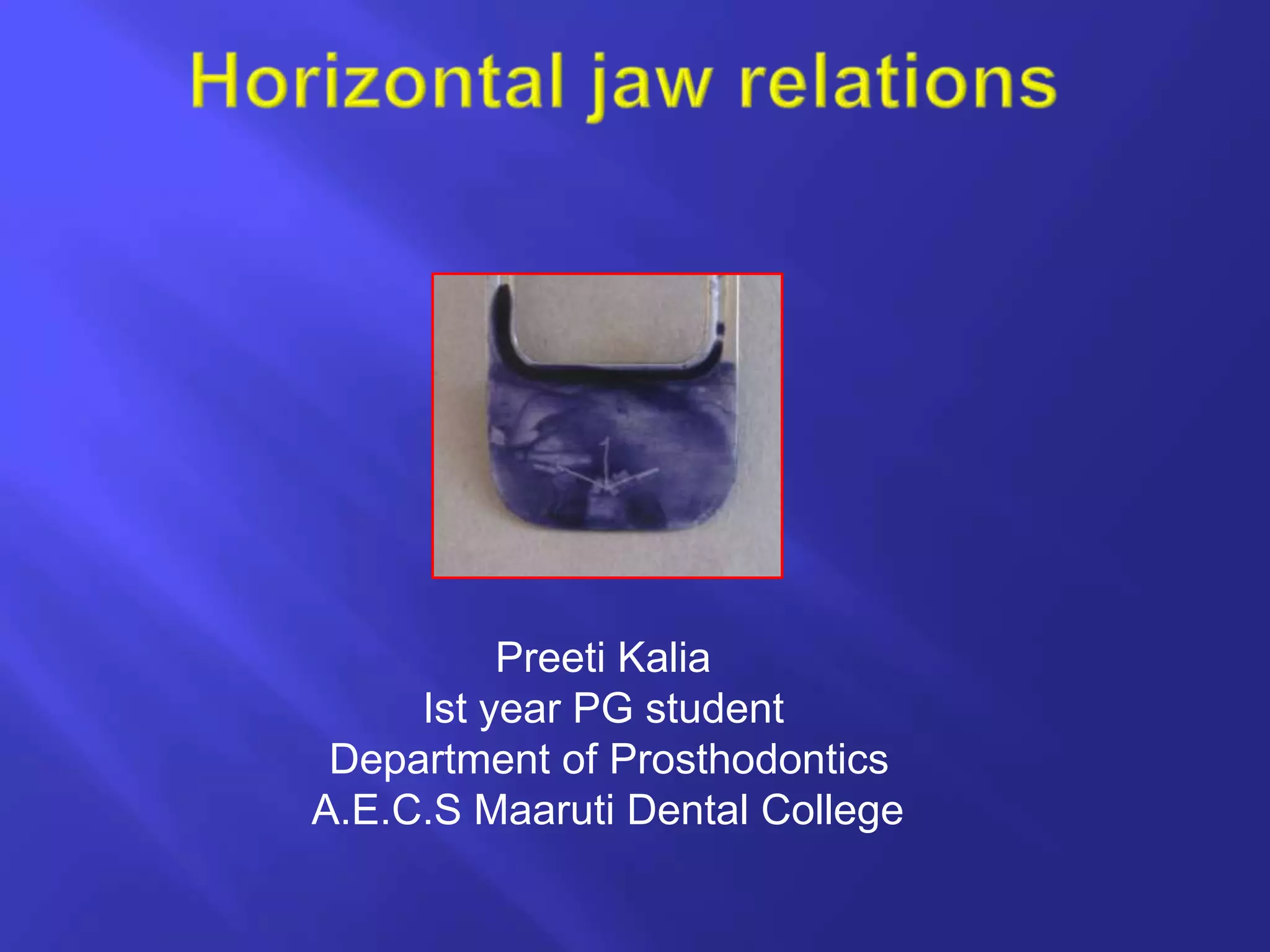 Horizontal jaw relations ppt PPT