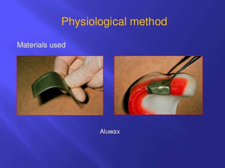 Horizontal jaw relations ppt