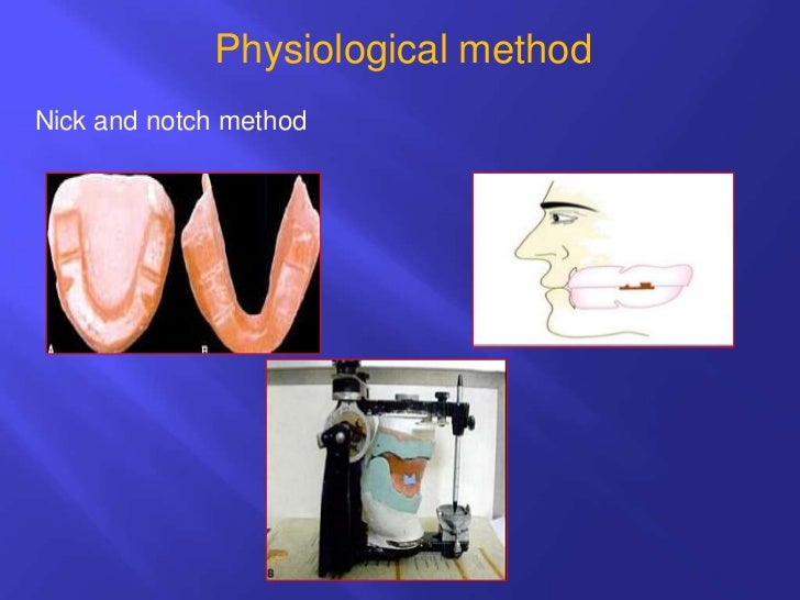 Horizontal jaw relations ppt