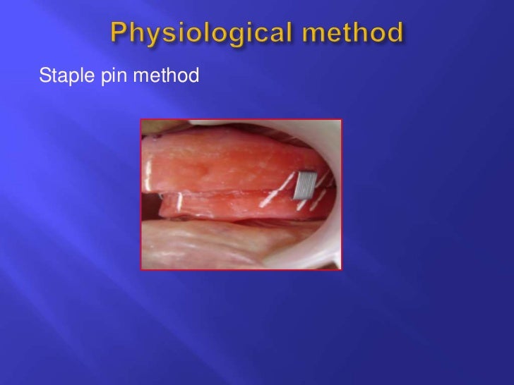 Horizontal jaw relations ppt