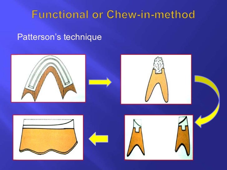 Horizontal jaw relations ppt