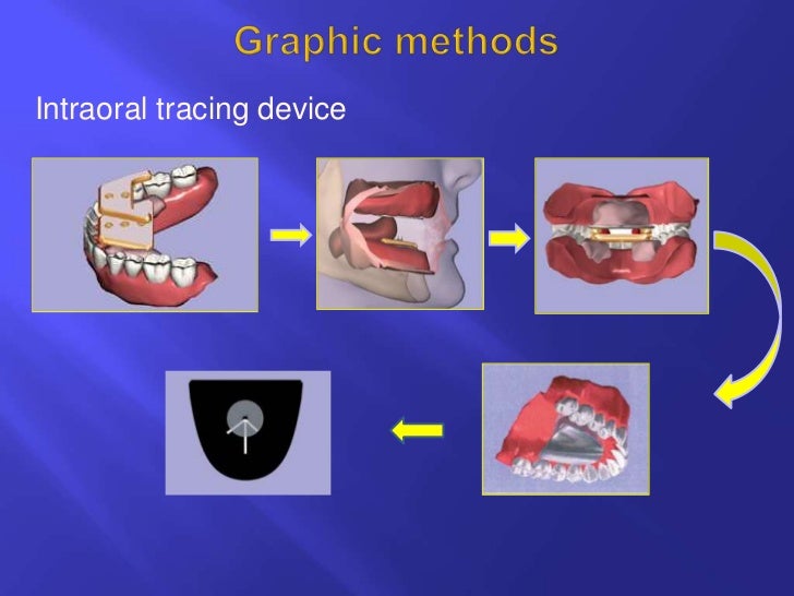 Horizontal jaw relations ppt