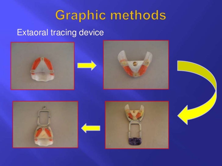 Horizontal jaw relations ppt
