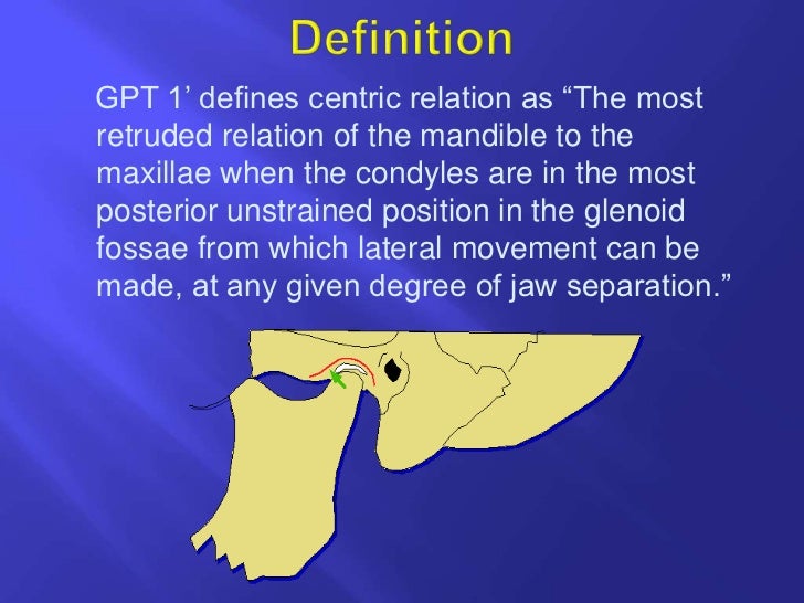 definitioneccentric relation records theories of centric relation techniques physiologic other functional graphic 3