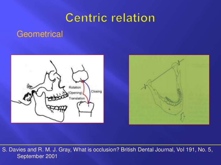 Horizontal jaw relations ppt