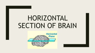 HORIZONTAL
SECTION OF BRAIN
 