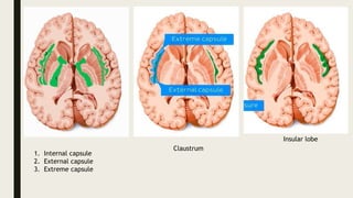 Horizontal section of brain.pptx