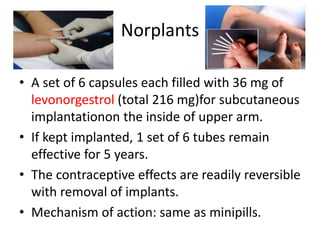 Norplants
• A set of 6 capsules each filled with 36 mg of
levonorgestrol (total 216 mg)for subcutaneous
implantationon the inside of upper arm.
• If kept implanted, 1 set of 6 tubes remain
effective for 5 years.
• The contraceptive effects are readily reversible
with removal of implants.
• Mechanism of action: same as minipills.
 