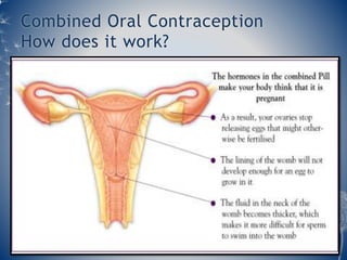 Combined Oral Contraception 
How does it work? 
 