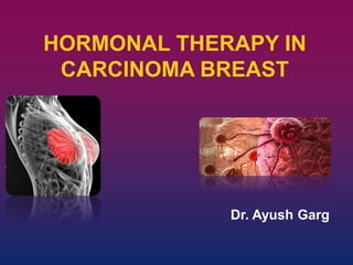 HORMONAL THERAPY IN
CARCINOMA BREAST
Dr. Ayush Garg
 
