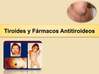 Tiroides y Fármacos Antitiroideos
 