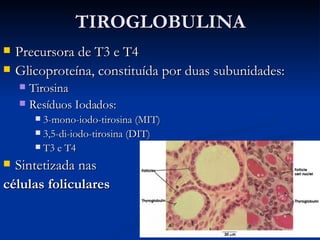 TIROGLOBULINA Precursora de T3 e T4 Glicoproteína, constituída por duas subunidades: Tirosina Resíduos Iodados: 3-mono-iodo-tirosina (MIT) 3,5-di-iodo-tirosina (DIT) T3 e T4 Sintetizada nas  células foliculares 