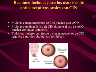 Recomendaciones para las usuarias de anticonceptivos orales con CIN Mujeres con antecedentes de CIN pueden usar ACO Mujeres con diagnóstico de CIN durante el uso de ACO, pueden continuar usándolos. Todas las mujeres con riesgo o con antecedentes de CIN requiere controles citológicos periódicos 