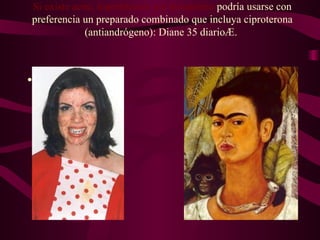 Si existe acné, hipertricosis y/o hirsutismo  podría usarse con preferencia un preparado combinado que incluya ciproterona (antiandrógeno): Diane 35 diario®.  