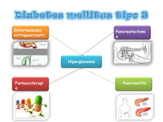 Hiperglucemia
Pancreatectomi
a
Pancreatitis
Enfermedades
extrapancreatic
as
Farmacoterapi
a
 