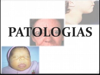 PATOLOGIAS
 