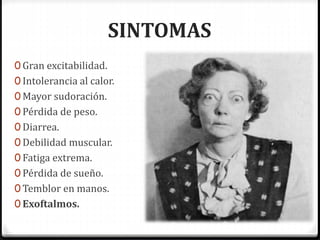 SINTOMAS
0 Gran excitabilidad.
0 Intolerancia al calor.
0 Mayor sudoración.
0 Pérdida de peso.
0 Diarrea.
0 Debilidad muscular.
0 Fatiga extrema.
0 Pérdida de sueño.
0 Temblor en manos.
0 Exoftalmos.
 