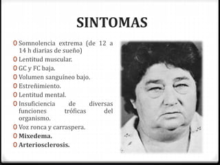 SINTOMAS
0 Somnolencia extrema (de 12 a
14 h diarias de sueño)
0 Lentitud muscular.
0 GC y FC baja.
0 Volumen sanguíneo bajo.
0 Estreñimiento.
0 Lentitud mental.
0 Insuficiencia de diversas
funciones tróficas del
organismo.
0 Voz ronca y carraspera.
0 Mixedema.
0 Arteriosclerosis.
 
