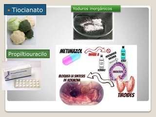  Tiocianato
Propiltiouracilo
Yoduros inorgánicos
 