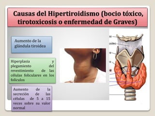 Causas del Hipertiroidismo (bocio tóxico,
tirotoxicosis o enfermedad de Graves)
Aumento de la
glándula tiroidea
Hiperplasia y
plegamiento del
revestimiento de las
células foliculares en los
folículos
Aumento de la
secreción de las
células de 5 a 15
veces sobre su valor
normal
 