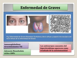 Enfermedad de Graves
Inmunoglobulinas
tiroestimulantes TSI
Adenosin Monofosfato
cíclico AMPc
Los anticuerpos causantes del
hipertiroidismo aparecen como
resultado de la autoinmunidad
 