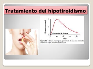 Tratamiento del hipotiroidismo
 