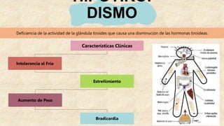HIPOTIROI
DISMO
Deficiencia de la actividad de la glándula tiroides que causa una disminución de las hormonas tiroideas.
Características Clínicas
Intolerancia al Frío
Estreñimiento
Aumento de Peso
Bradicardia
 