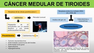 CÁNCER MEDULAR DE TIROIDES
Neoplasia de las células parafoliculares C
calcitonina Marcador tumoral
Polipéptido de 32
aminoácidos con un puente
disulfuro y una amida
prolínicacarboxi-terminal
Procalcitonina Calcitonina madura
• Tumores neuroendocrinos
• Enfermedades autoinmunes del tiroides
• Enfermedad renal grave
• Hipercalcemia
• Hipergastrinemia.
Neoplasia endocrina múltiple (MEN-
2A o MEN-2B)
Análisis del gen ret Catecolaminas y
metanefrinas
Feocromocitoma
 