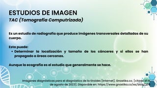 ESTUDIOS DE IMAGEN
TAC (Tomografía Computrizada)
Determinar la localización y tamaño de los cánceres y si ellos se han
propagado a áreas cercanas.
Es un estudio de radiografía que produce imágenes transversales detalladas de su
cuerpo.
Esta puede:
Aunque la ecografía es el estudio que generalmente se hace.
Imágenes diagnósticas para el diagnóstico de la tiroides [Internet]. Gnostika.co. [citado el 16
de agosto de 2023]. Disponible en: https://www.gnostika.co/es/blog/209
 
