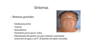 ▶ Síntomas generales:
◦ Intoleranciaal frío
◦ Astenia
◦ Somnolencia
◦ Desinterés porlo que lo rodea
◦ Disminucióndelapetito con peso normalo aumentado
(retención deagua y sal 2° aldepósito detejido mucoide).
Síntomas
 