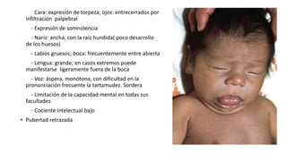 - Cara: expresión de torpeza; ojos: entrecerrados por
infiltración palpebral
- Expresión de somnolencia
- Nariz: ancha, con la raíz hundida( poco desarrollo
de los huesos)
- Labios gruesos; boca: frecuentemente entre abierta
- Lengua: grande; en casos extremos puede
manifestarse ligeramente fuera de la boca
- Voz: áspera, monótona, con dificultad en la
pronunciación frecuente la tartamudez. Sordera
- Limitación de la capacidad mental en todas sus
facultades
- Cociente intelectual bajo
• Pubertad retrazada
 