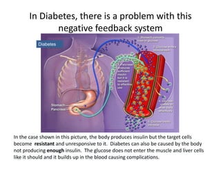 In the case shown in this picture, the body produces insulin but the target cells
become resistant and unresponsive to it. Diabetes can also be caused by the body
not producing enough insulin. The glucose does not enter the muscle and liver cells
like it should and it builds up in the blood causing complications.
Diabetes
In Diabetes, there is a problem with this
negative feedback system
 