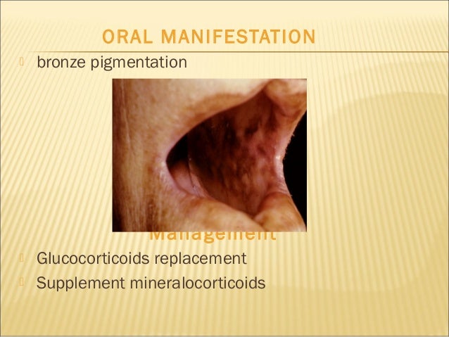 Hormones And Oral Health ppt Final