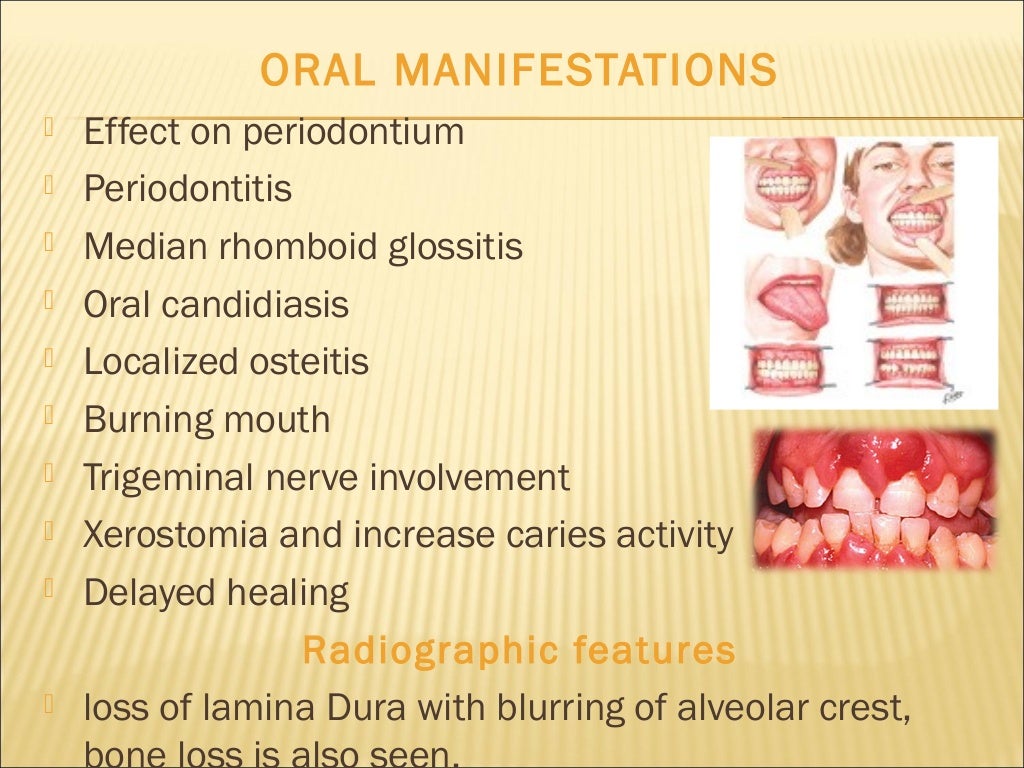 Hormones And Oral Health ppt Final
