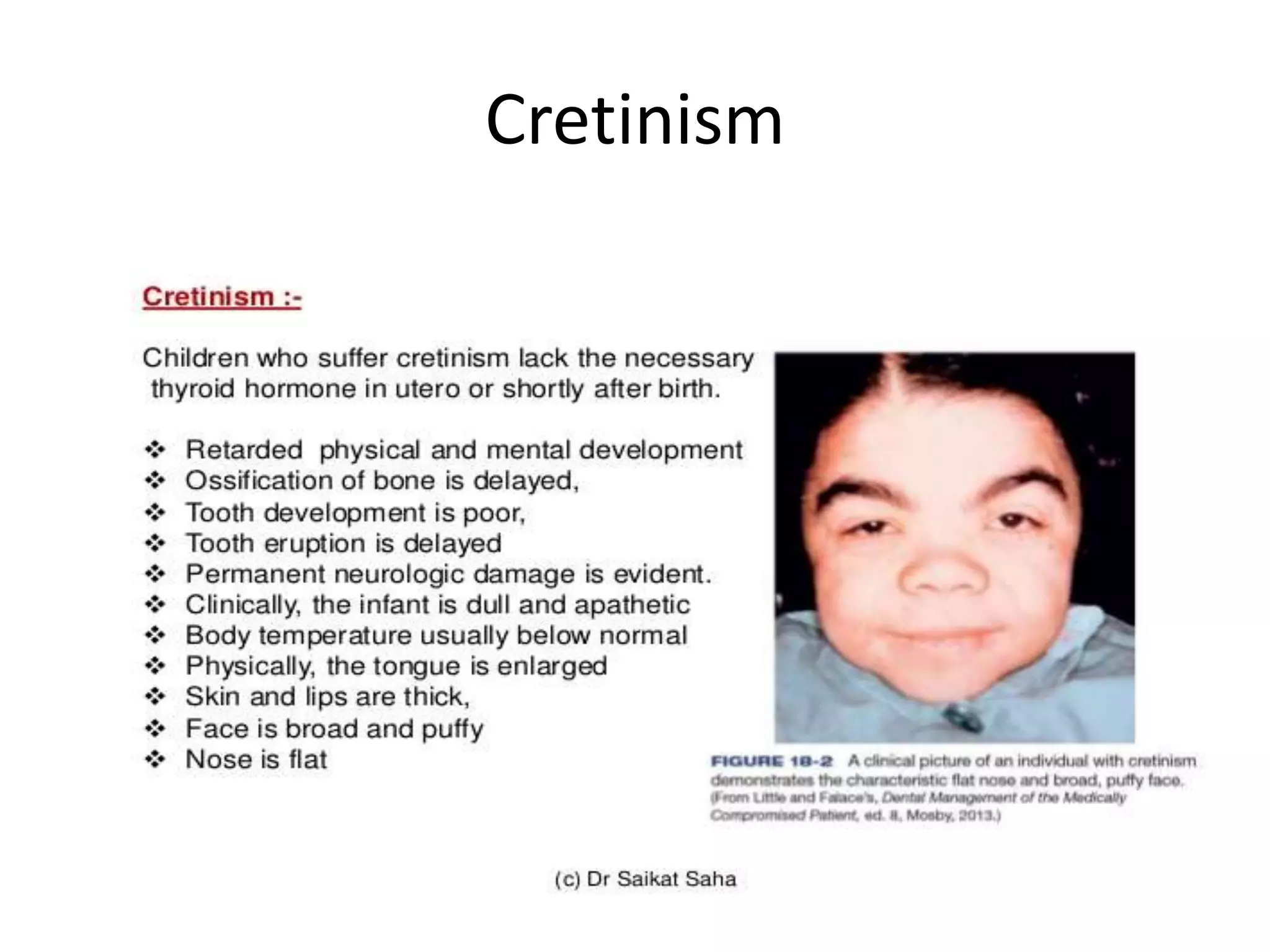 Anterior Pituitary hormones & Thyroid Hormones PPT
