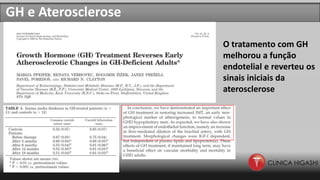 GH e Aterosclerose
O tratamento com GH
melhorou a função
endotelial e reverteu os
sinais iniciais da
aterosclerose
 