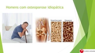 Homens com osteoporose idiopática
 