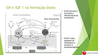 GH e IGF 1 na formação óssea
• O GH estimula a
formação e
diferenciação do
osteoblasto.
• O IGF1 reduz
apoptose do
osteoblasto e
promove a
osteoblastogênese
 