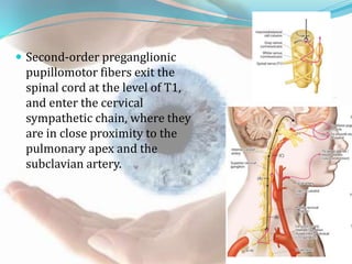 Horners syndrome | PPTX