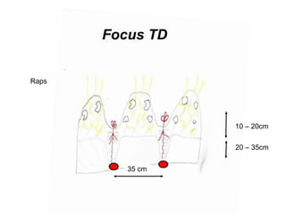 Focus TD


Raps




                  10 – 20cm

                  20 – 35cm


          35 cm
 