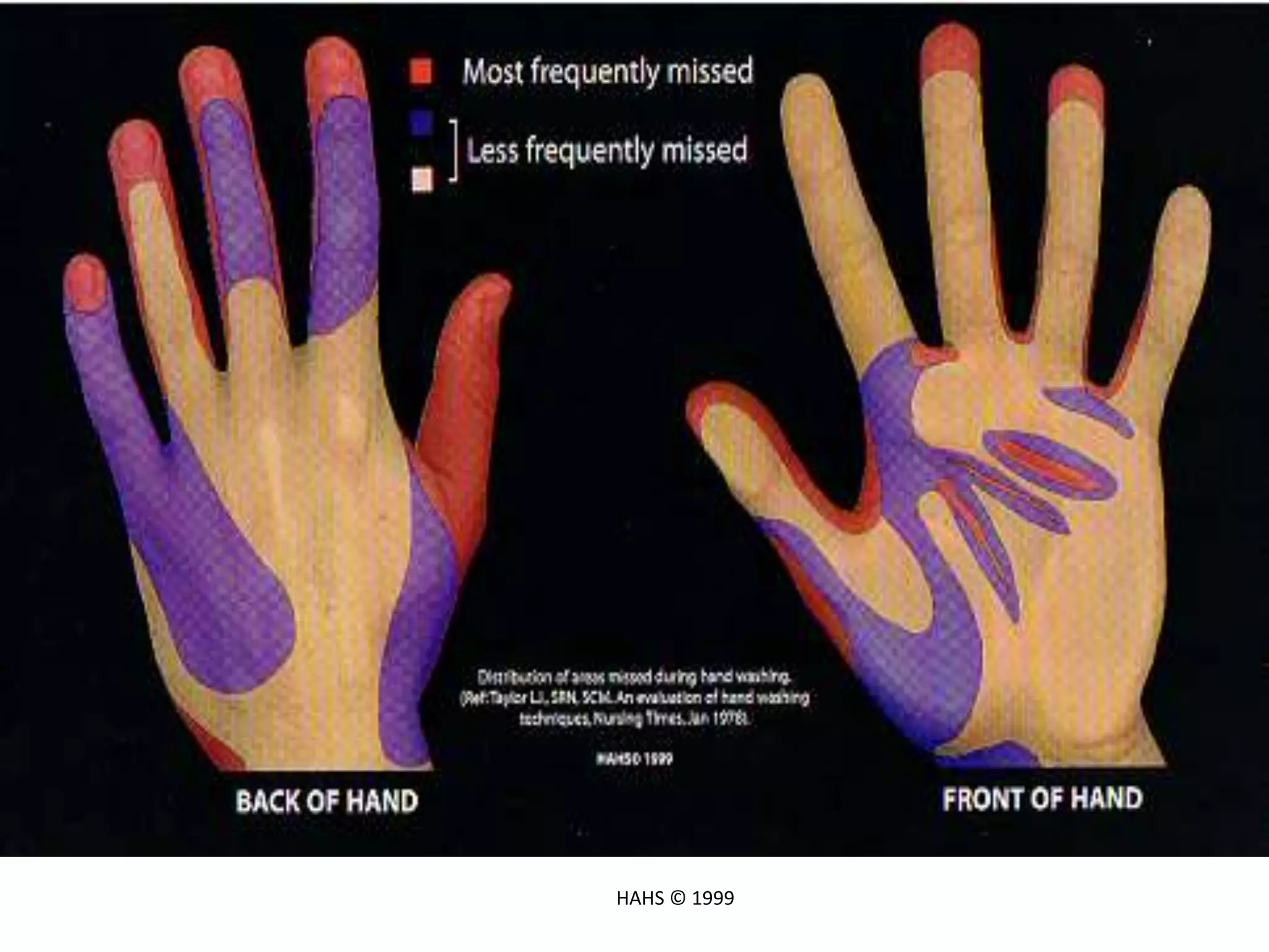 Areas Most Frequently Missed
HAHS © 1999