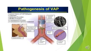 HOSPITAL ACQUIRED PNEUMONIA PULMONOLOGY UNIT.pptx