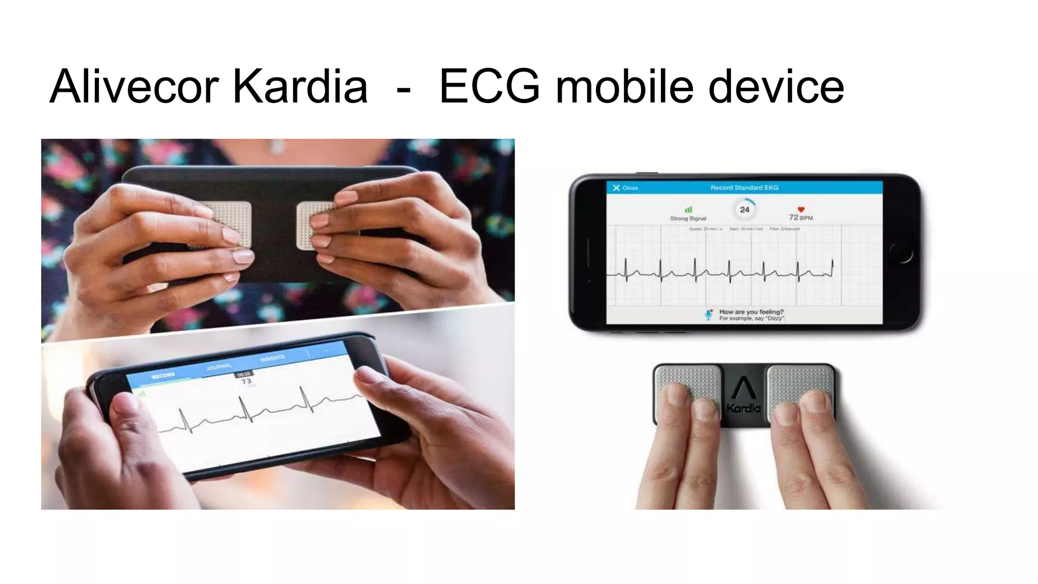 Alivecor Kardia - ECG mobile device