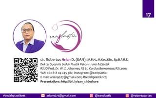#bedahplastikntt @robertusarian
arian9677@gmail.com @eanplastic
dr. Robertus Arian D. (EAN), M.P.H.,M.Ked.Klin.,Sp.B.P.R.E.
Dokter Spesialis Bedah Plastik Rekonstruksi & Estetik
RSUD Prof. Dr. W. Z. Johannes; RS St. Carolus Borromeus; RS Leona
WA: +62 818 04 245 382; Instagram: @eanplastic;
E-mail: arian9677@gmail.com; #bedahplastikntt;
Presentations: http://bit.ly/ean_slideshare
17
 