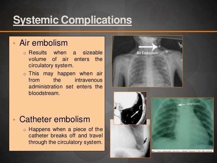 Hospital pharmacy report intravenous admixtures