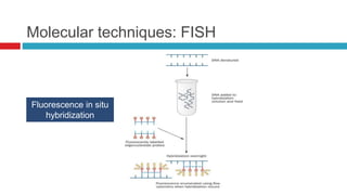 Molecular techniques: FISH
Fluorescence in situ
hybridization
 