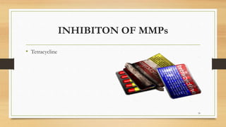 INHIBITON OF MMPs
• Tetracycline
30
 