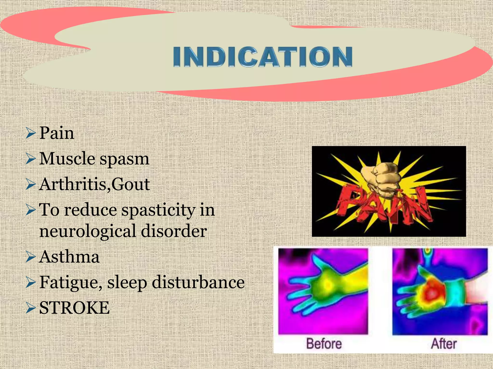 Pain
Muscle spasm
Arthritis,Gout
To reduce spasticity in
neurological disorder
Asthma
Fatigue, sleep disturbance
STROKE