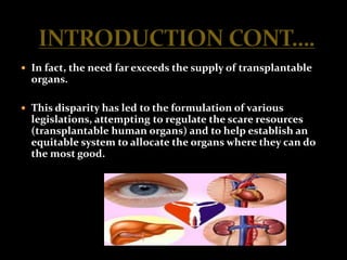  In fact, the need far exceeds the supply of transplantable
  organs.

 This disparity has led to the formulation of various
  legislations, attempting to regulate the scare resources
  (transplantable human organs) and to help establish an
  equitable system to allocate the organs where they can do
  the most good.
 