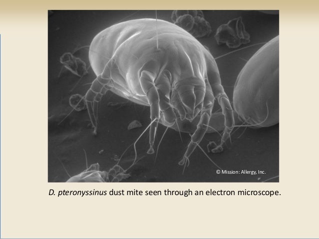 House Dust Mites Allergy Jeffrey D Miller Md